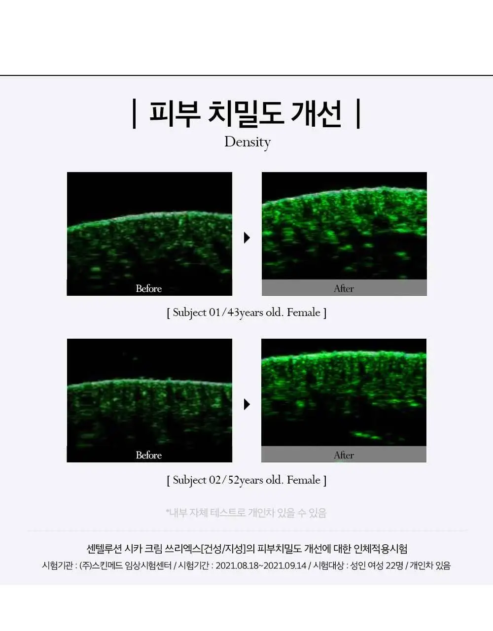 피부미 센텔루션 시카 크림 3X 100ml [건성] 상세페이지 10